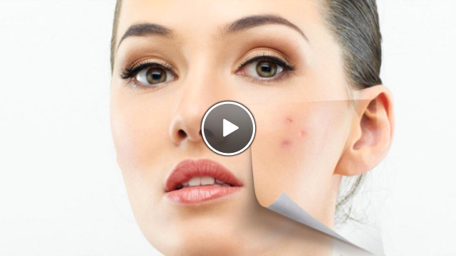 Leke Tedavi Yöntemleri Nelerdir?